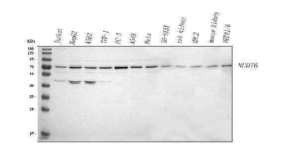  Western blot analysis of NUDT6 using anti-NUDT6 antibody (A08301-1)