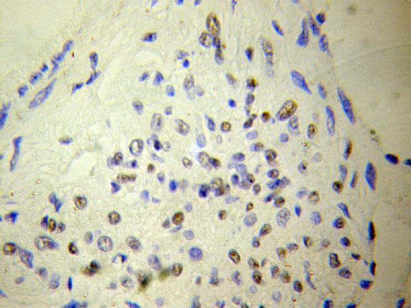 Immunofluorescence analysis of HeLa cells using NUDT6 antibody 