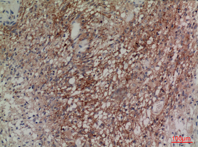 Immunohistochemical analysis of paraffin-embedded human-brain, antibody was diluted at 1:100