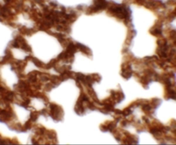 a08303 neto1 primary antibodies ihc testing 2