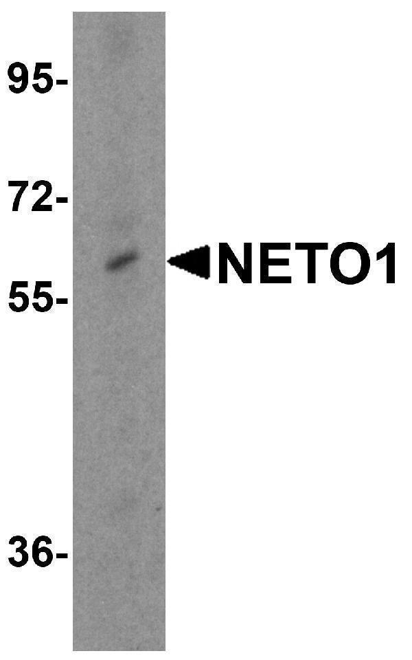 a08303 neto1 primary antibodies wb testing 1