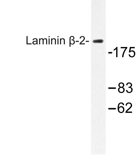 Western blot (WB) analysis of Laminin β-2 (C91) polyclonal antibody at 1:500 dilution
Lane1:PC12 whole cell lysate(40ug)
Lane2:MCF-7 whole cell lysate(40ug)
Lane3:NIH-3T3 whole cell lysate(40ug)
