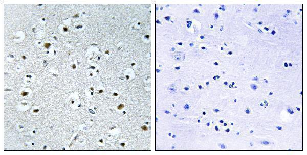 a08308 1 pprc1 primary antibodies ihc testing 1