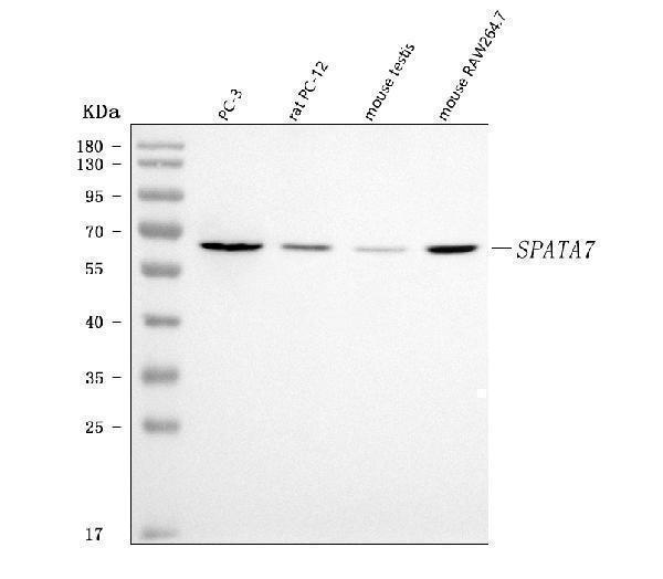  Western blot analysis of SPATA7 using anti-SPATA7 antibody (A08310-1)