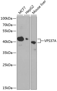 a08314 vps37a primary antiboties wb testing 1