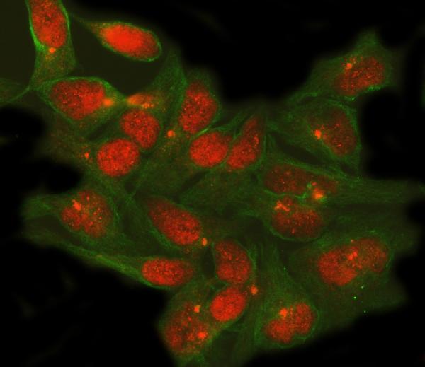 a08315 1 tshz1 primary antibodies if testing 2