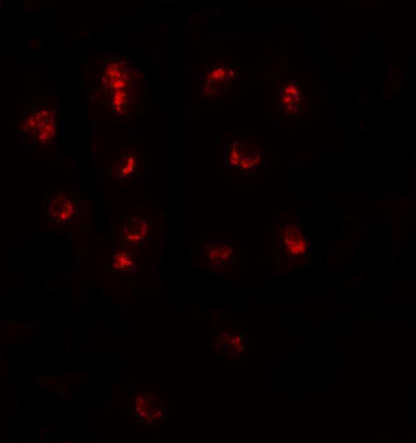 a08315 tshz1 primary antibodies if testing 3
