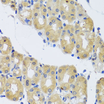 a08316 dync1i1 primary antiboties ihc testing 2