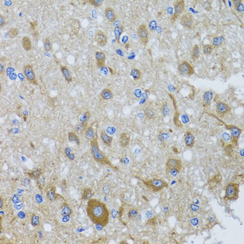 a08316 dync1i1 primary antiboties ihc testing 3