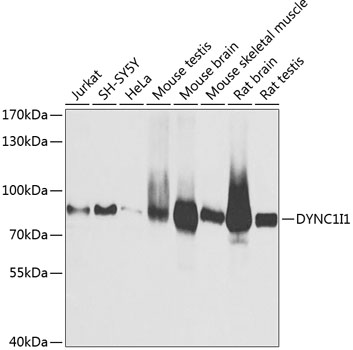 a08316 dync1i1 primary antiboties wb testing 1