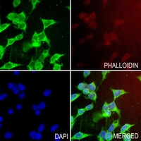 a08320 c4bpb primary antiboties if testing 3