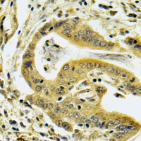 a08320 c4bpb primary antiboties ihc testing 2