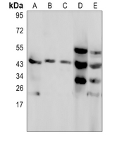 a08320 c4bpb primary antiboties wb testing 1