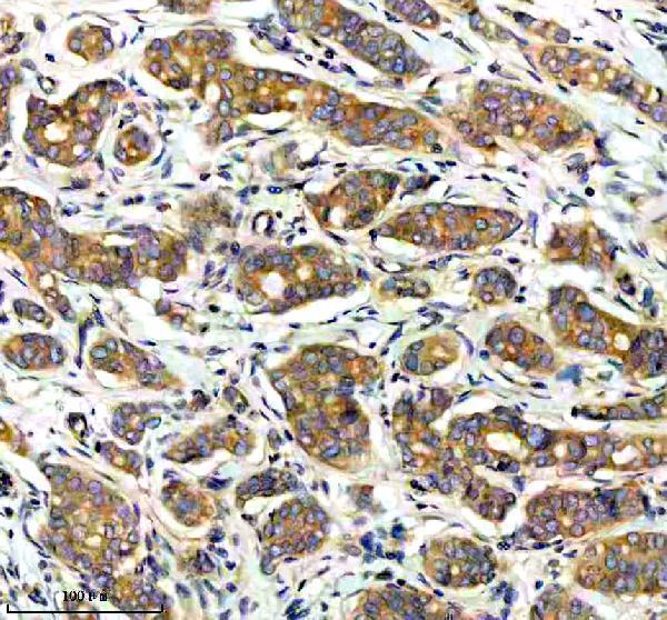 IHC analysis of CAMLG using anti-CAMLG antibody (A08322-2)