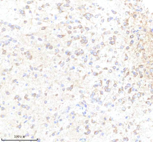 IHC analysis of CAMLG using anti-CAMLG antibody (A08322-2)