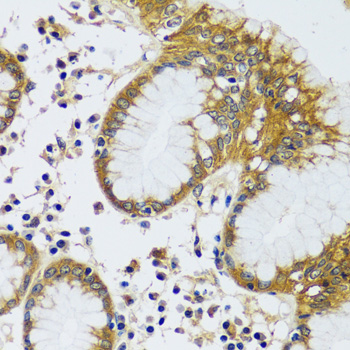 Immunohistochemistry of paraffin-embedded human stomach using CAMLG antibody  at dilution of 1:100 
