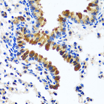 Immunohistochemistry of paraffin-embedded mouse lung using CAMLG antibody  at dilution of 1:100 