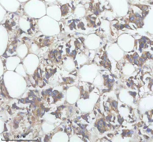 a08338 2 dpp7 primary antibodies ihc testing 1