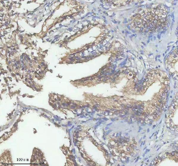 a08338 2 dpp7 primary antibodies ihc testing 2