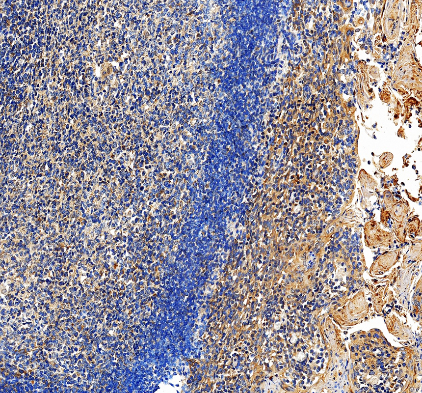 IHC analysis of IL-31 using anti-IL-31 antibody (A08339-1)