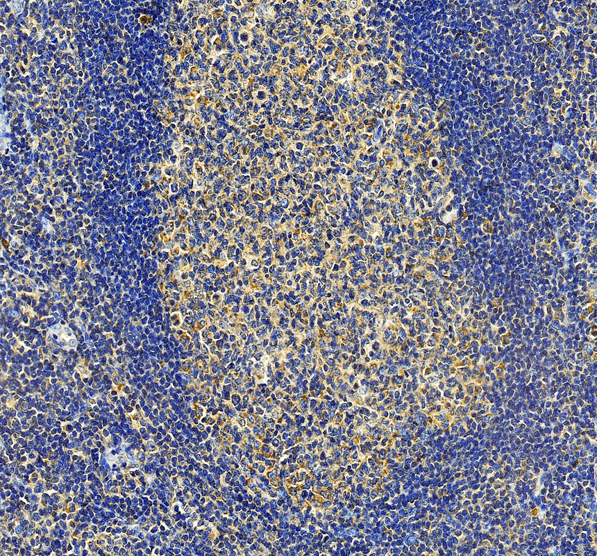 IHC analysis of IL-31 using anti-IL-31 antibody (A08339-1)