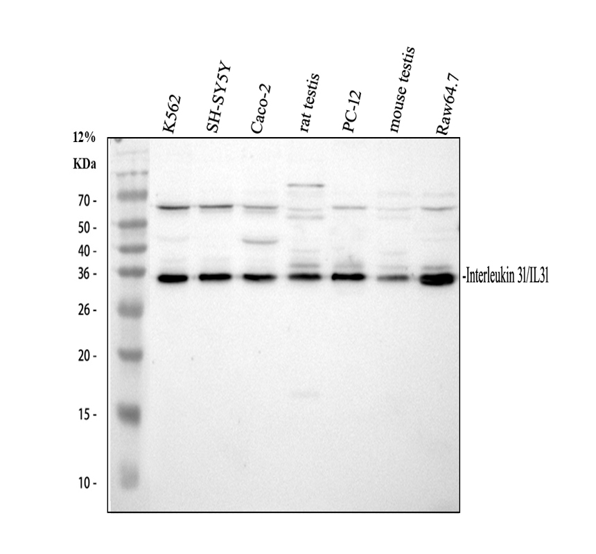 Western blot analysis of IL-31 using anti-IL-31 antibody (A08339-1)