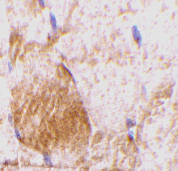 a08339 il31 primary antibodies ihc testing 2