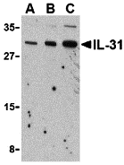 a08339 il31 primary antibodies wb testing 1
