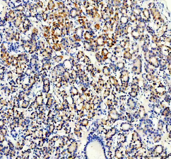 IHC analysis of Synip/STXBP4 using anti-Synip/STXBP4 antibody (A08343-1)