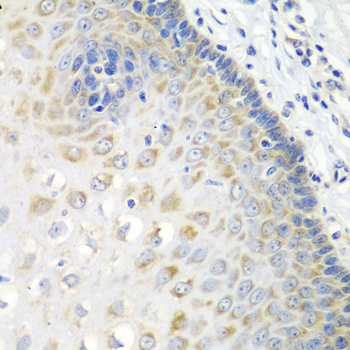 Immunohistochemistry of paraffin-embedded human esophagus using STXBP4 antibody  at dilution of 1:100 