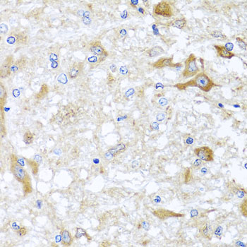 Immunohistochemistry of paraffin-embedded rat brain using ABCB8 antibody  at dilution of 1:100 