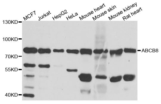 Western blot analysis of extracts of various cell lines, using ABCB8 antibody  at 1:1000 dilution