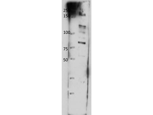 Western Blot of Rabbit anti-ABCB8 antibody