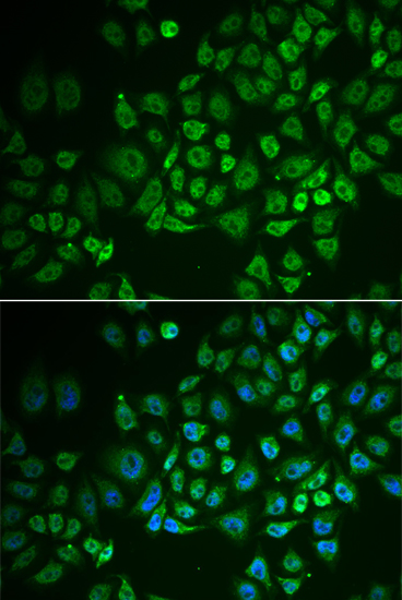 a08347 gpld1 primary antiboties if testing 1