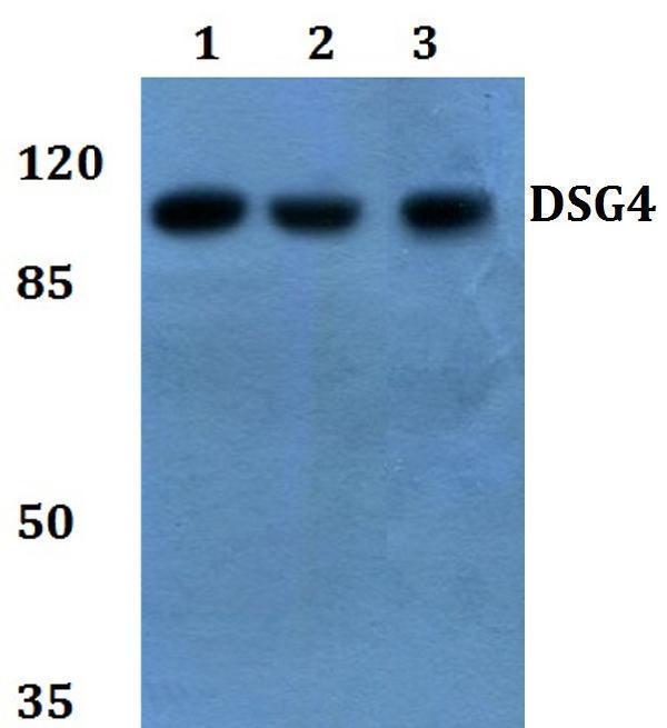 Western blot (WB) analysis of Desmoglein 4 polyclonal antibody at 1:500 dilution
Lane1:HEK293T whole cell lysate
Lane2:sp2/0 whole cell lysate
Lane3:H9C2 whole cell lysate