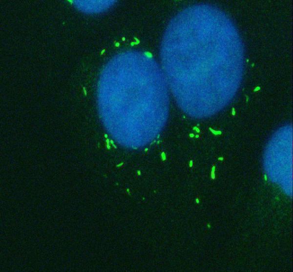  IF analysis of CAPN5 using anti-CAPN5 antibody (A08350-1)