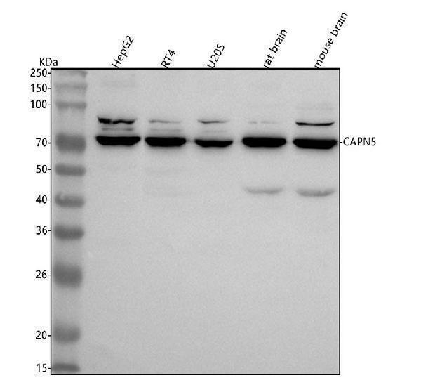  Western blot analysis of CAPN5 using anti-CAPN5 antibody (A08350-1)
