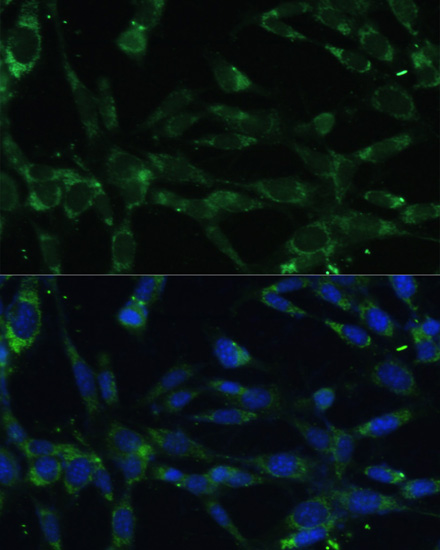 Immunofluorescence analysis of NIH-3T3 cells using CAPN5 antibody  at dilution of 1:100