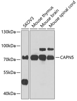 Western blot analysis of extracts of various cell lines, using CAPN5 antibody  at 1:1000 dilution