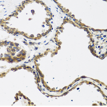 a08354 calcb primary antiboties ihc testing 2
