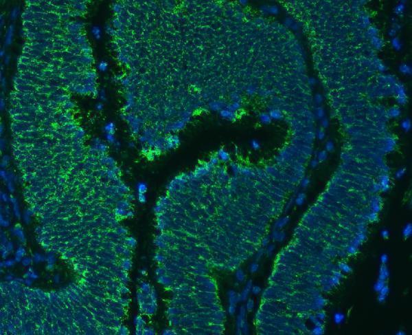 a08355 1 slc25a24 primary antibodies if testing 13