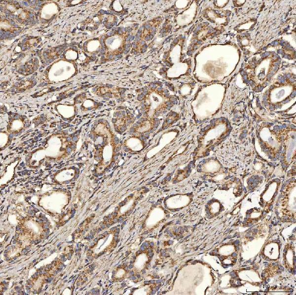 a08355 1 slc25a24 primary antibodies ihc testing 10