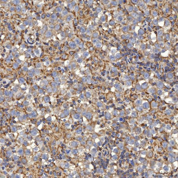a08355 1 slc25a24 primary antibodies ihc testing 12