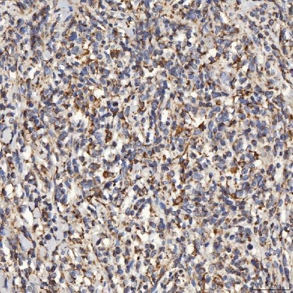  IHC analysis of SLC25A24 using anti-SLC25A24 antibody (A08355-1)