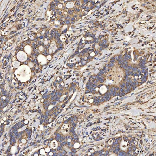  IHC analysis of SLC25A24 using anti-SLC25A24 antibody (A08355-1)