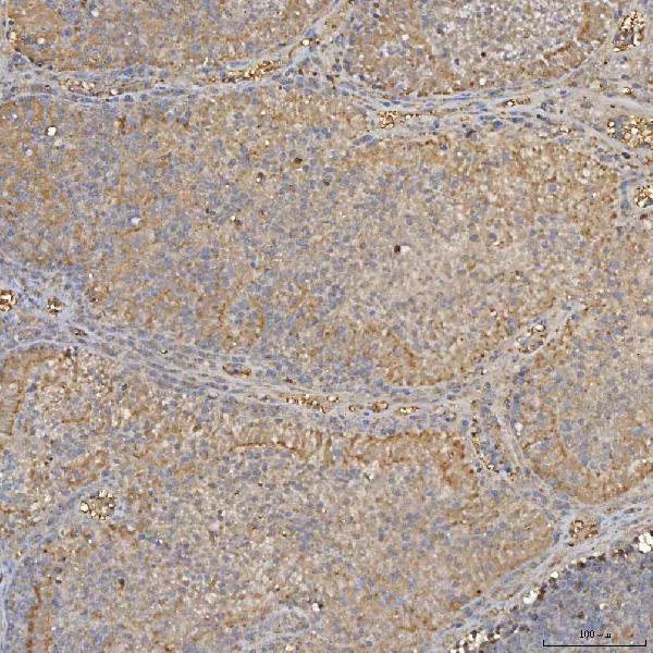 a08355 1 slc25a24 primary antibodies ihc testing 4