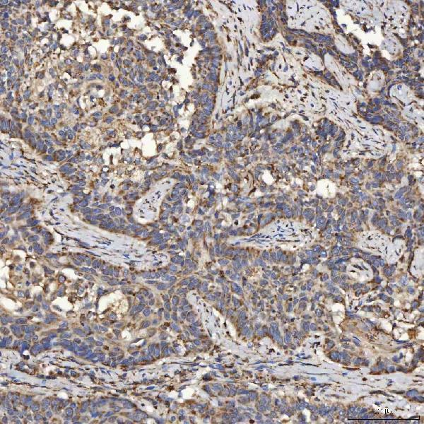a08355 1 slc25a24 primary antibodies ihc testing 6