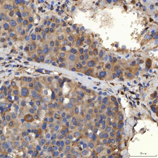 a08355 1 slc25a24 primary antibodies ihc testing 7