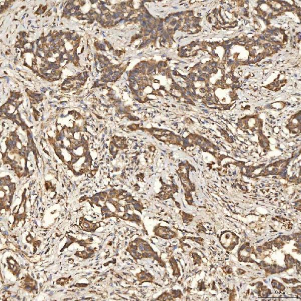 a08355 1 slc25a24 primary antibodies ihc testing 8
