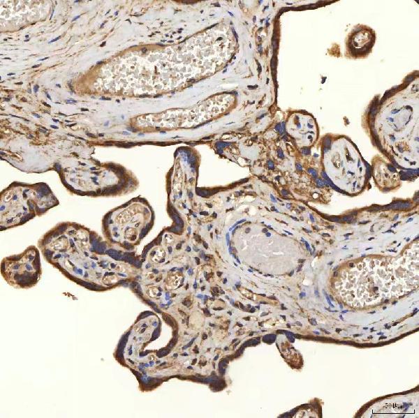 a08355 1 slc25a24 primary antibodies ihc testing 9